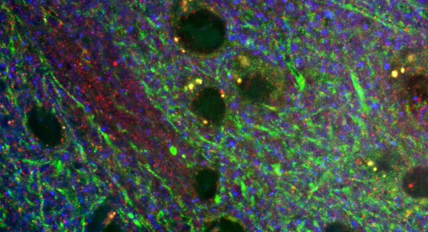 Postsynaptic density protein-95 in the brain