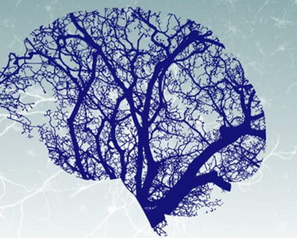 A brain outline with a blue tree with it's branches filling up the outline of the brain.